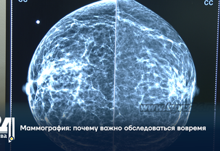 Маммография: почему важно обследоваться вовремя
