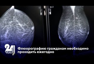 Флюорографию гражданам необходимо проходить ежегодно