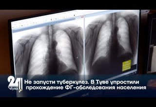 Не запусти туберкулез. В Туве упростили прохождение ФГ-обследования населения