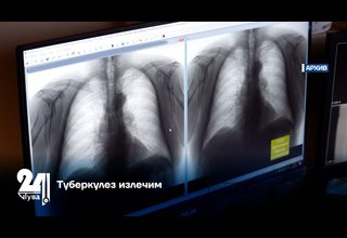 Туберкулез излечим